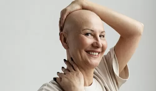 ¿Por qué salen calvas en las mujeres? ¿Por qué salen calvas en las mujeres?