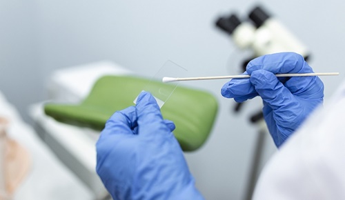 ¿Hasta qué edad hay que hacerse el test de Papanicolaou?